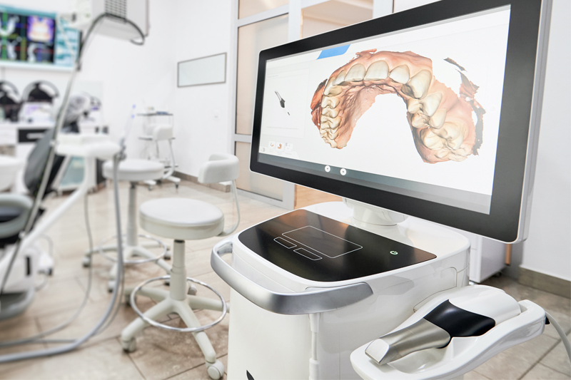 Itero Intra-Oral Scanner in Matawan